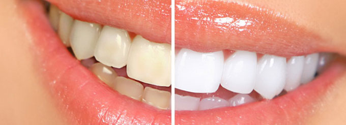Estetica dentara Estetica dentara